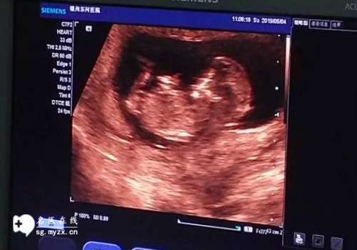 2023年徐州第一人民醫(yī)院試管嬰兒攻略，內(nèi)附成功率與費用構(gòu)成！_1