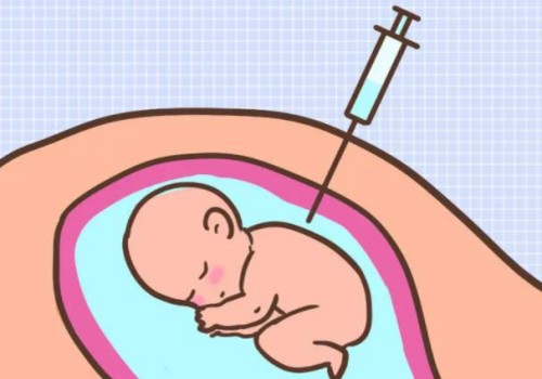 促卵泡生成素低的表現(xiàn)有哪些？通過這些可以進行一定的治療