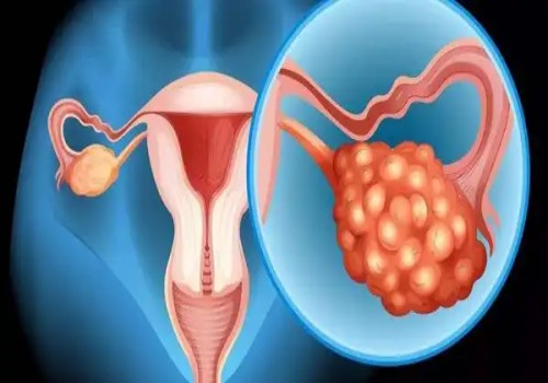 寧波試管助孕價(jià)格：怎樣通過(guò)孕檢單判斷胎兒性別？教你正確看懂孕檢單