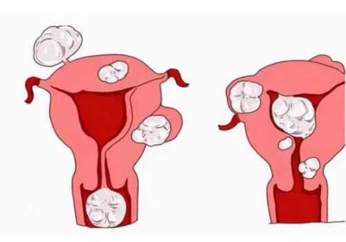 寧波助孕機構：四維彩超也能看出胎兒性別，男孩女孩有這四方面區(qū)別
