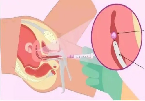 寧波三代試管助孕：產婦坐月子是42天還是30天？到底哪一個正確