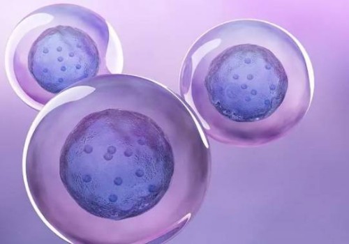 易發(fā)唐氏兒的孕婦群體，做好預(yù)防措施必不可少