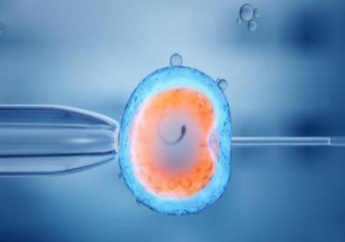 羊水穿刺染色體報(bào)告解讀：是男孩還是女孩一目了然！