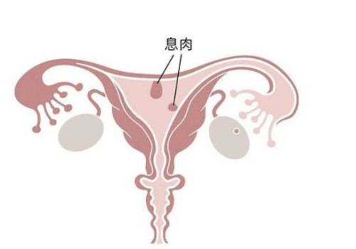 寧波正規(guī)助孕機構：睪丸越多生育能力越強不可信，多睪癥有什么危害