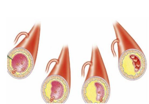 寧波供卵試管：超詳細(xì)的試管嬰兒移植全流程分享，從開始到成功只需要五步